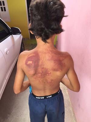 Menino foi agredido em Jacobina (Foto: Augusto Jacobina / site Augusto Urgente!)